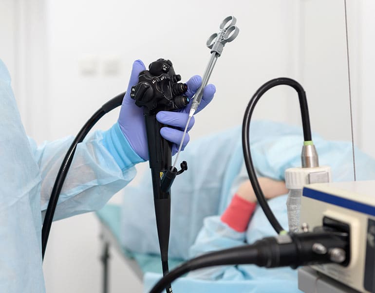 日帰りポリープ切除が可能